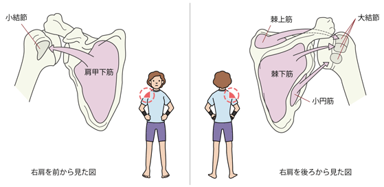 どうしても肩が上がらない 貴方の肩は五十肩ではないかもしれません 現場レポート 骨と関節が痛い方をサポートするwebサイト 関節ライフ