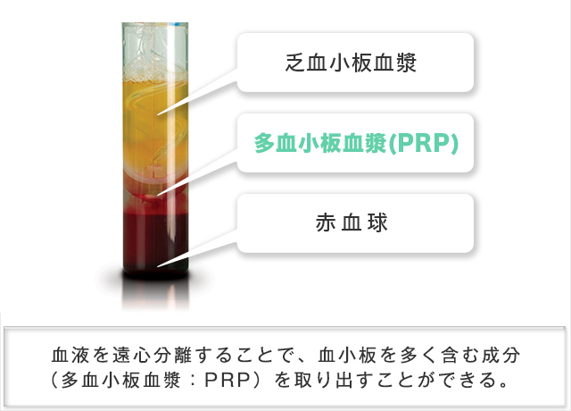PRP分離イメージ