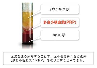 PRP分離イメージ