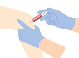 PRP療法、APS療法は、ご自身の血液を使う